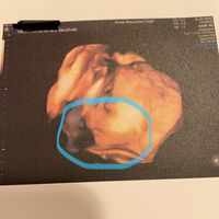 💙💜future mamme di Maggio 2022💙💜 - 1