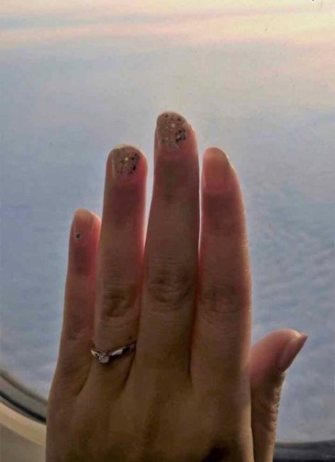 Anello proposta. Quali sono i vostri? - 2