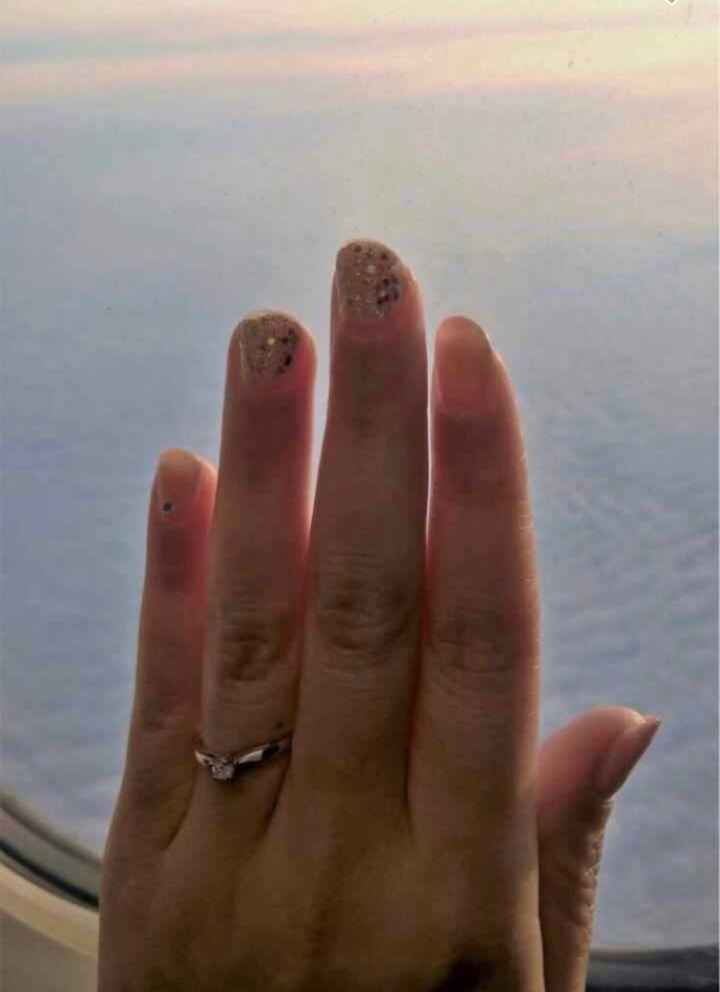 Anello proposta. Quali sono i vostri? - 2