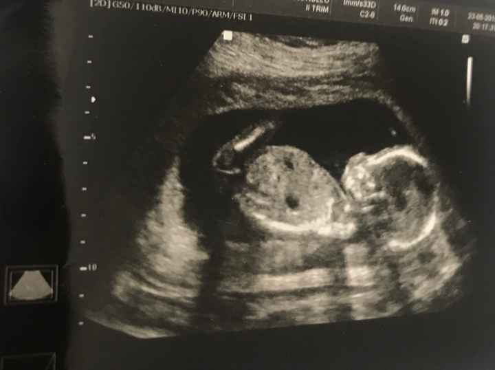 Future mamme di novembre - 1