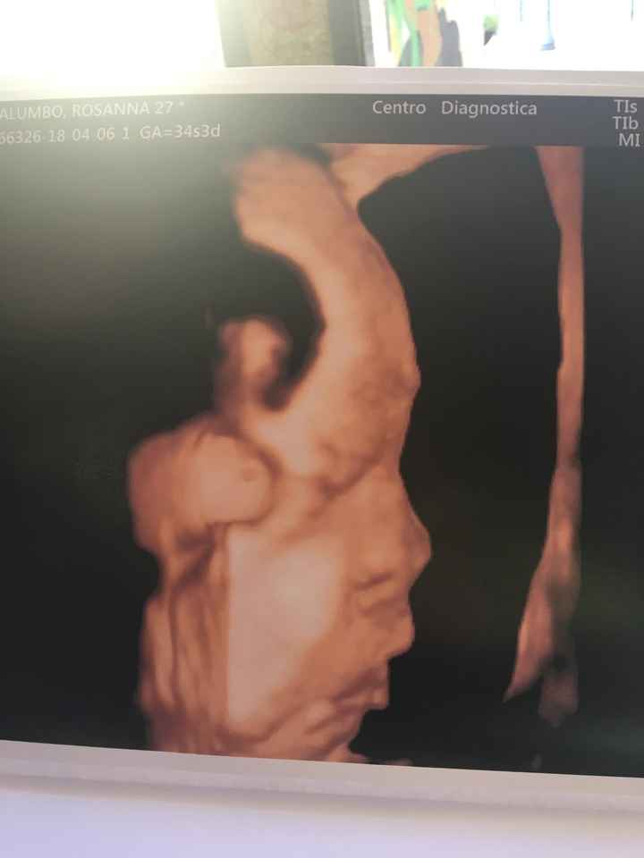 34+3 ❤️❤️❤️ - 1