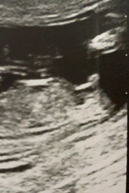 Ramzi ne ha beccate 2 su 2❤️❤️ 5