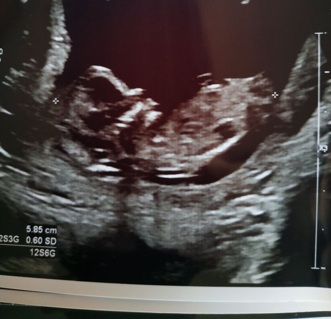 Future Mamme Maggio 2021❤️ - 1