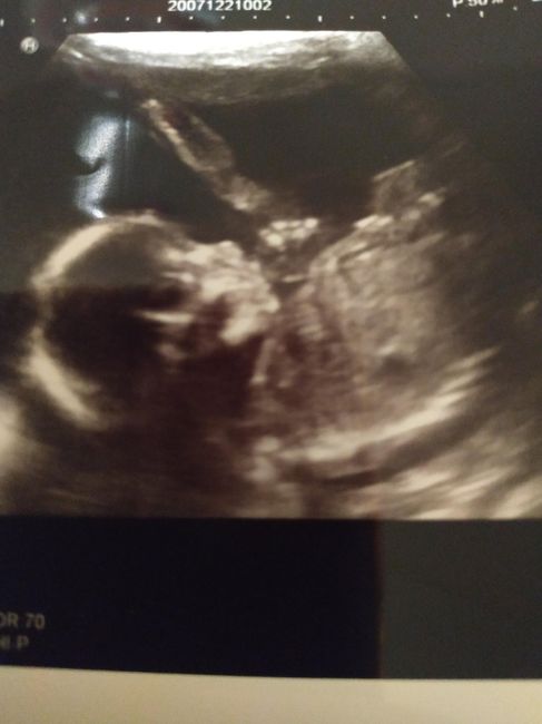 Future Mamme Maggio 2021❤️ - 1