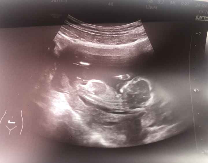 Future mamme Febbraio 2025 - 1