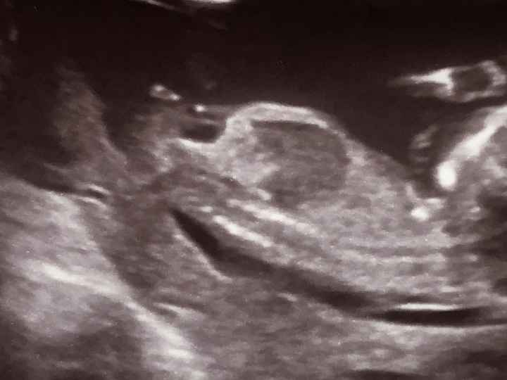 Future mamme Febbraio 2025 - 1