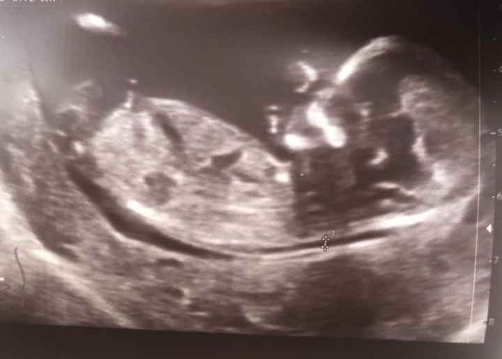 Future mamme Febbraio 2025 - 2