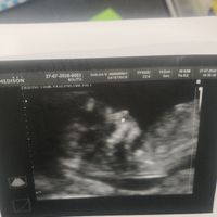 Future Mamme Febbraio 2021 - 1