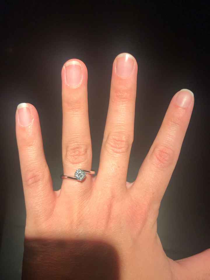 Anello - 1