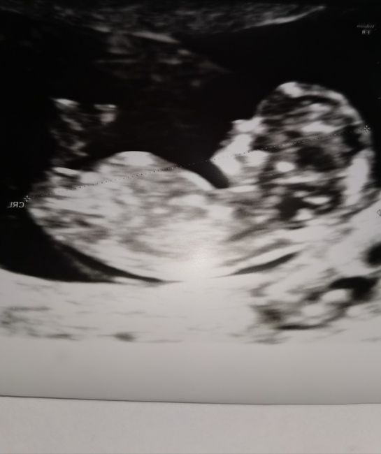 Esperte Nub Theory - 1