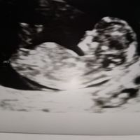 Esperte Nub Theory - 1