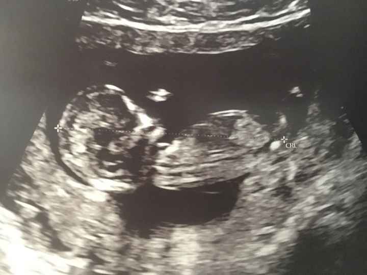 Nub Theory: a chi va di gioca un po’?? - 1