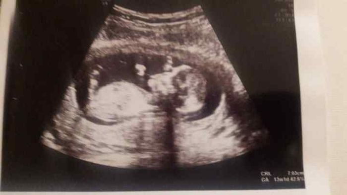 Chi conosce la Nub Theory? 💙o💖? - 1