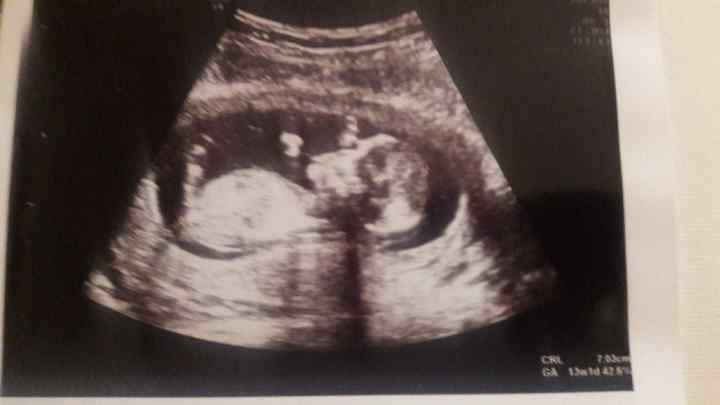 Metodo Ramzi pareri - 1