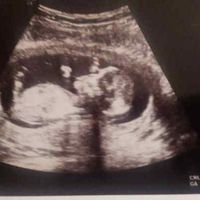 Chi conosce la Nub Theory? 💙o💖? - 1