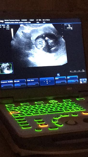 Mamme di Gennaio 2020 ❤️ - 1