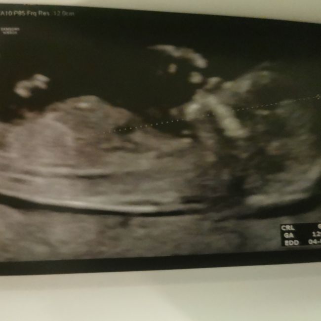 Future mamme Agosto 2021! - 1