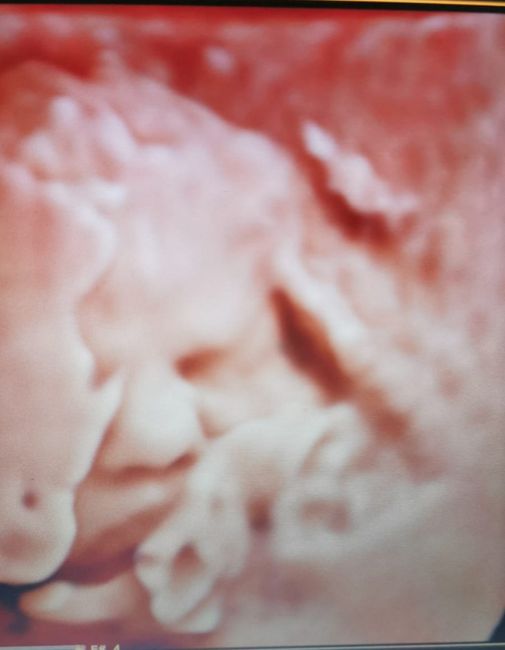 Future mamme Agosto 2021! - 1