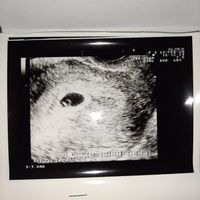 Metodo Ramzi! Chi ci sa azzeccare? - 2