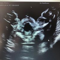 Ecografia,. Maschio o femmina? - 1