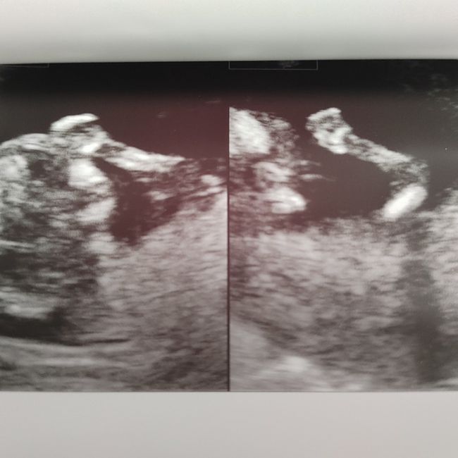 Future mamme novembre 2021 - 1