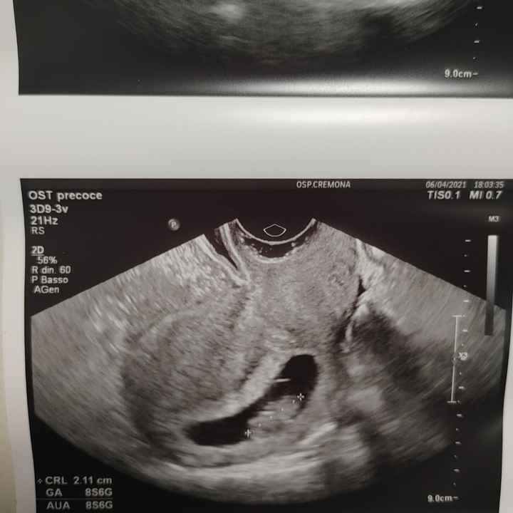 Future mamme novembre 2021 - 1