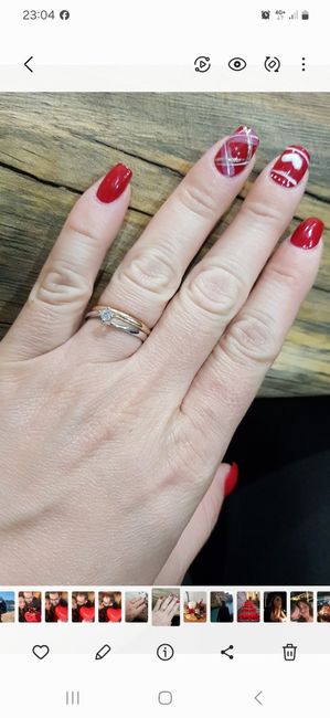 Anello 4