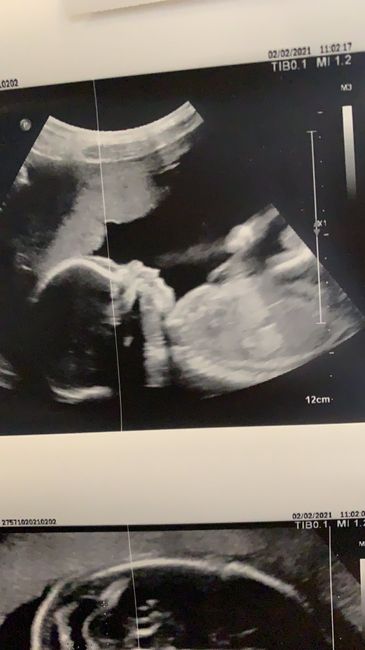 Future mamme Giugno 2021 💛🐠🍀🌻 1