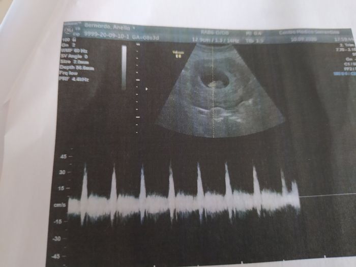 Future mamme di Aprile 2021 🐣 - 1