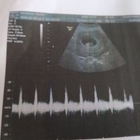 Future mamme di Aprile 2021 🐣 - 1