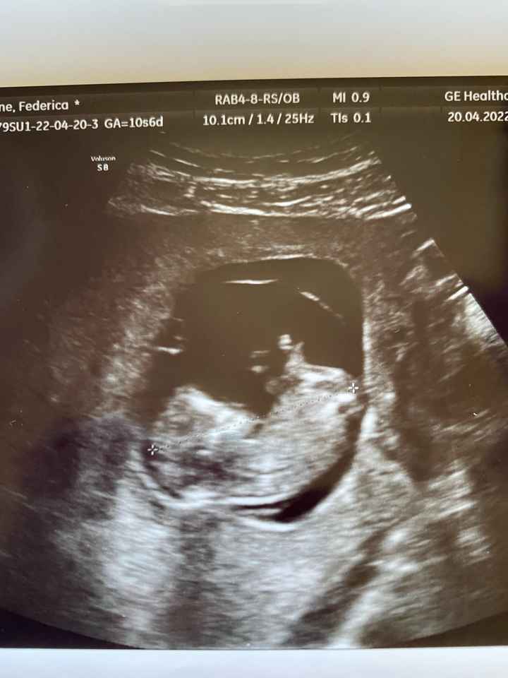 Nub theory 😂😂😂😂 - 1