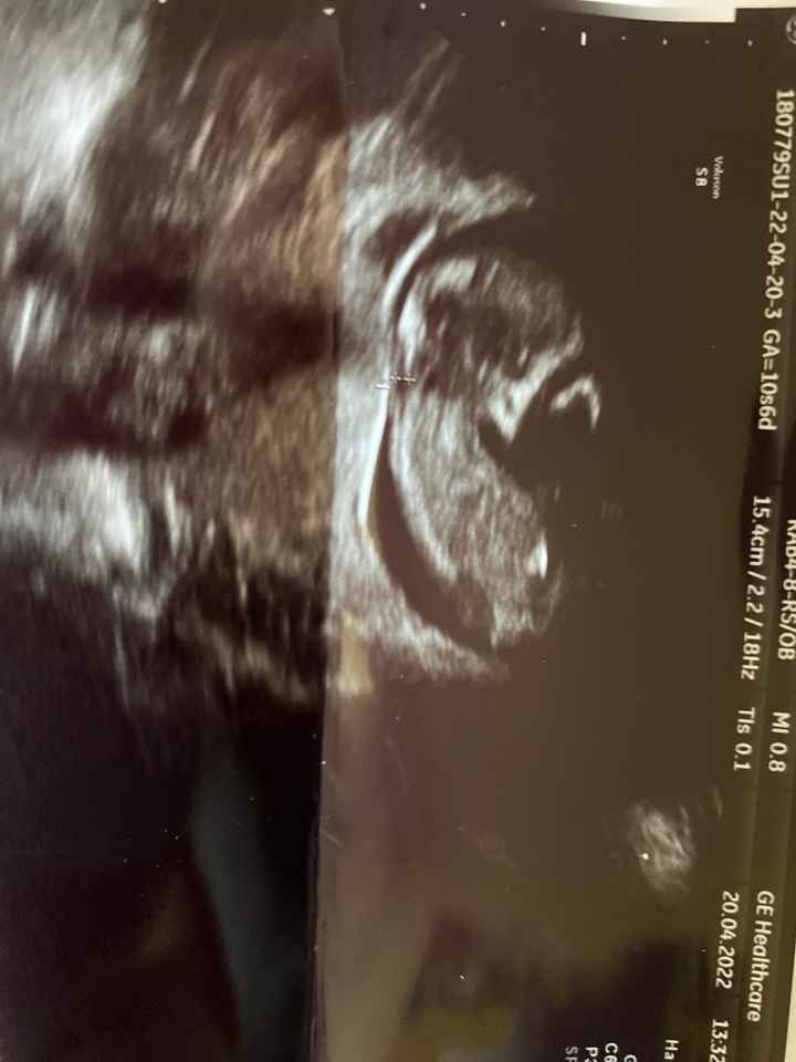 Nub theory 😂😂😂😂 - 1