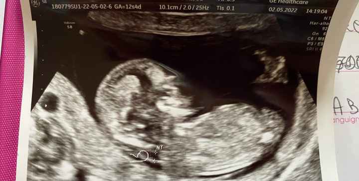 Nub theory 😂😂😂😂 - 1