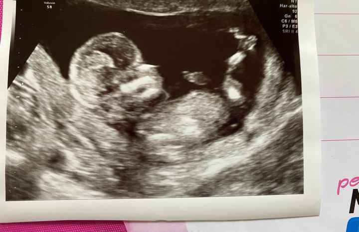 Nub theory 😂😂😂😂 - 2