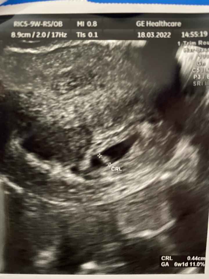 Metodo Ramzi eco a 6sett e 8sett - 1