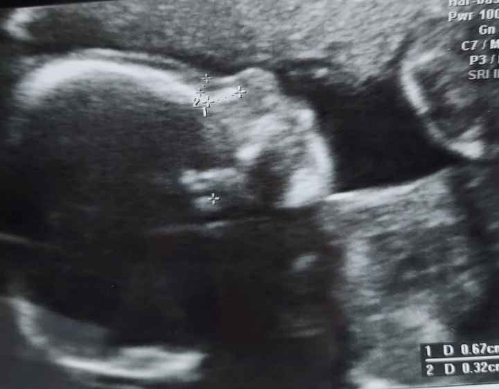 Future mamme Marzo 2021 - 1