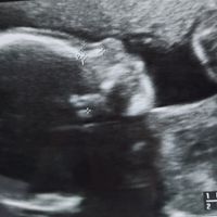 Future mamme Marzo 2021 - 1