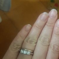 Anello di fidanzamento - 1