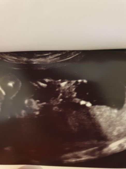 Future mamme novembre 2020 🌞🍁🌷♾ - 1