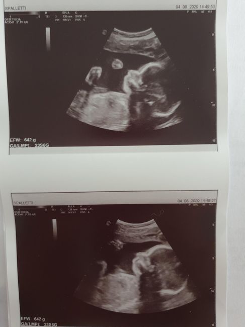 Future mamme novembre 2020 🌞🍁🌷♾ - 1