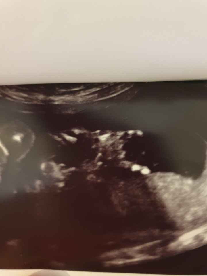Future mamme novembre 2020 🌞🍁🌷♾ - 1