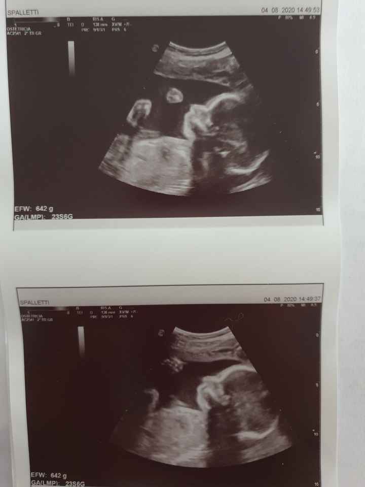 Future mamme novembre 2020 🌞🍁🌷♾ - 1