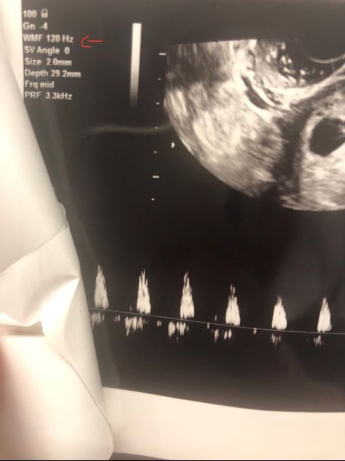 Future mamme Agosto 2021! - 1