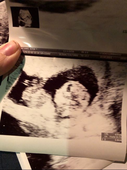 Future mamme Agosto 2021! - 1