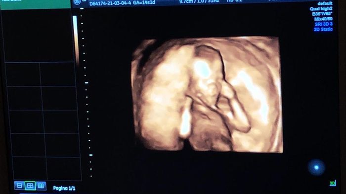 Future mamme Agosto 2021! - 1