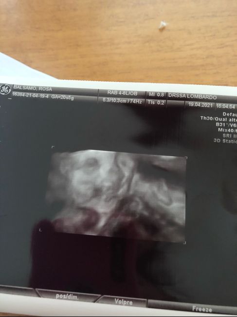 Future mamme Agosto 2021! - 1