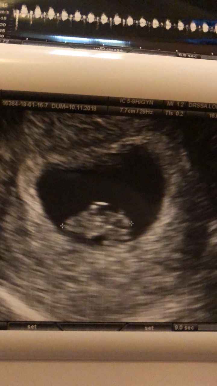 Mamme di Agosto 2019 - 1