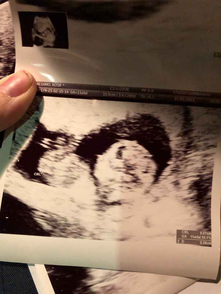 Future mamme Agosto 2021! - 1