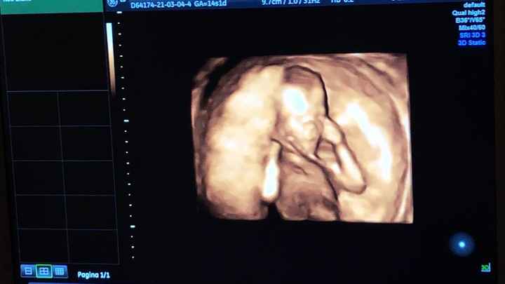 Future mamme Agosto 2021! - 1