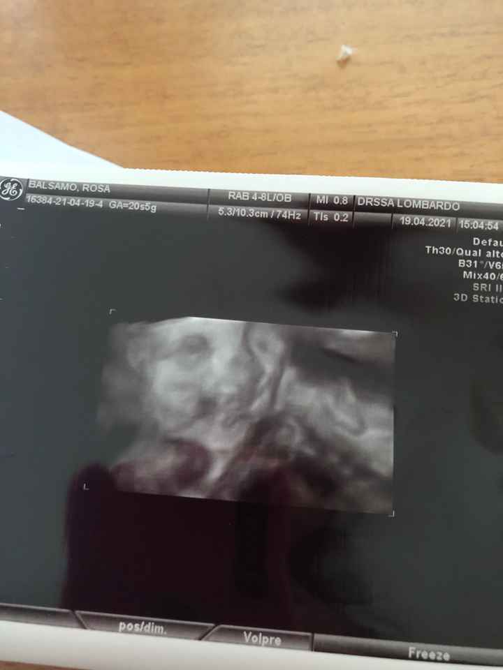 Future mamme Agosto 2021! - 1